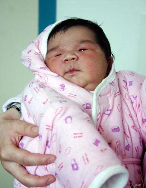 8 bé sơ sinh vừa chào đời đãto nhất thế giới - 5
