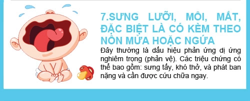 Dấu hiệu lạ bé mắc trọng bệnh - 4