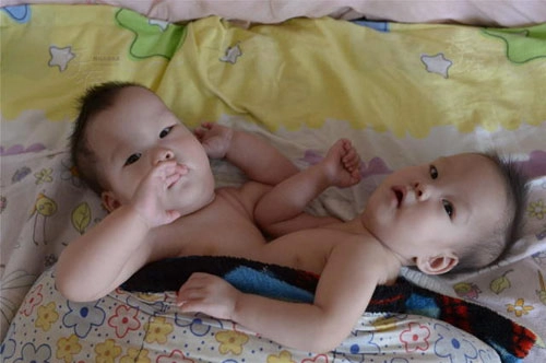 Đau xót những em bé bị bỏ rơi vì bệnh tật - 1