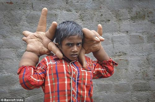 Kinh ngạc bé 8 tuổi có bàn tay lớn hơn đầu người - 1