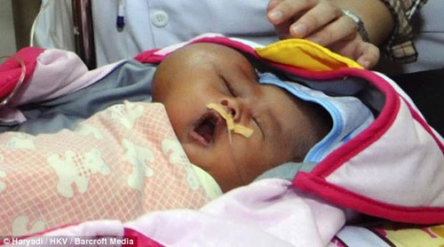 Những bé sơ sinh kỳ lạ khiến y học thế giới kinh ngạc - 3