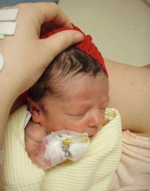 Những bé sơ sinh kỳ lạ khiến y học thế giới kinh ngạc - 1