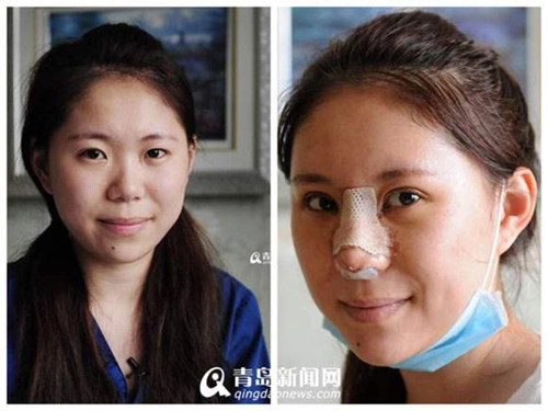 Phẫu thuật toàn bộ gương mặt để đỡ phải trang điểm - 9