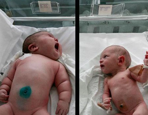 8 bé sơ sinh vừa chào đời đãto nhất thế giới - 1