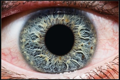 Đây là ý nghĩa của chấm đen trên mống mắt hãy kiểm tra ngay - 1