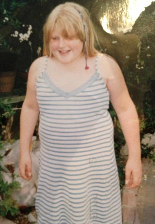 Hành trình cân nặng bất thường của cô gái béo phì - 7