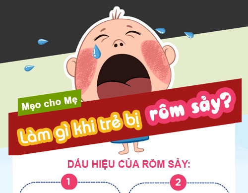 Infographics xử bay rôm sảy mùa hè cho bé - 1