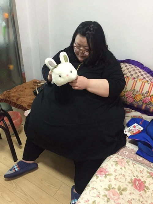 Trung quốc cô gái phải cắt dạ dày để giảm cân - 2
