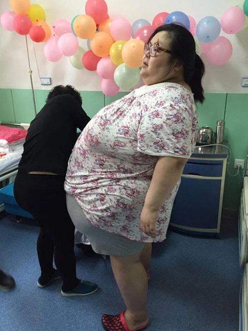 Trung quốc cô gái phải cắt dạ dày để giảm cân - 5