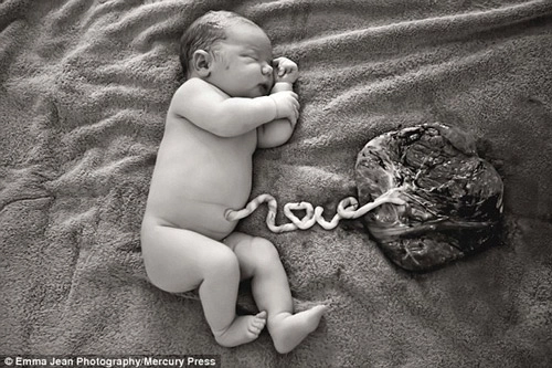 Ảnh bé mới sinh có dây rốn hình chữ love gây sốt mạng - 1