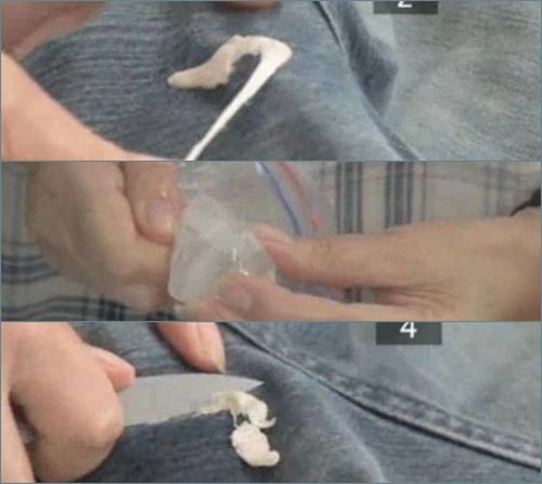 Gỡ kẹo cao su tẩy trắng quần áo nhờ tủ lạnh - 1