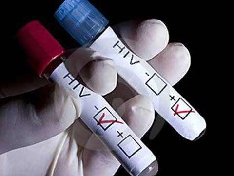  hiểu đúng về hiv để tránh những nỗi lo hão - 1