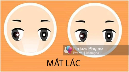 Cách kiểm tra mắt trẻ sơ sinh bị lác mẹ nào cũng cần biết - 3