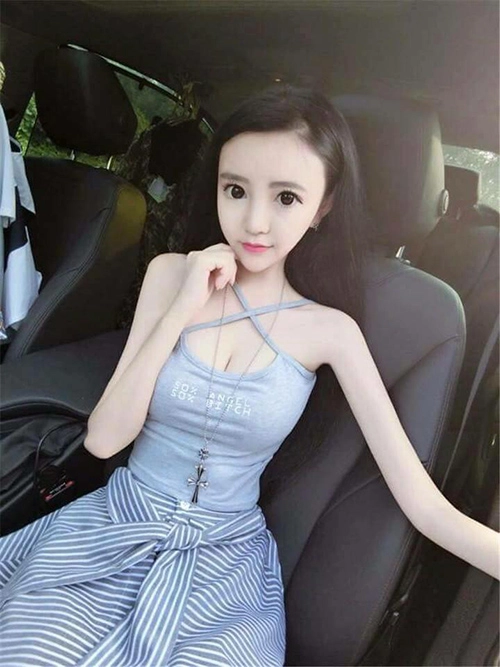 Chỉ nặng vẻn vẹn 20kg cô gái 15 tuổi vẫn tự nhận là hot girl - 2