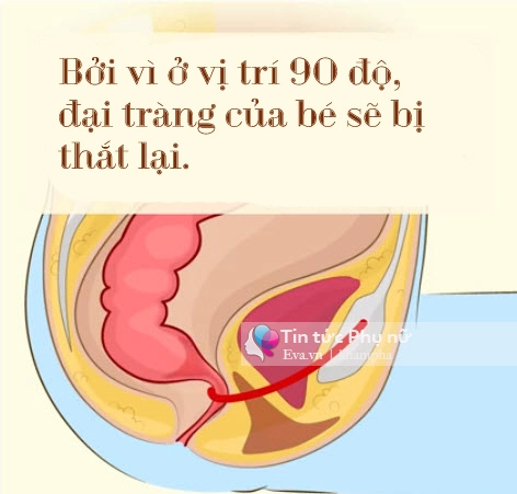 Chỉ vì chiếc bồn cầu con có nguy cơ bị ung thư đại tràng - 5