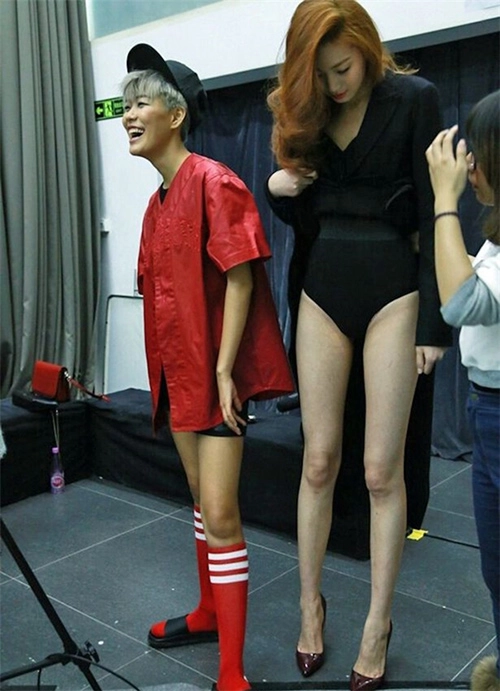 Cô gái sở hữu đôi chân dài bất thường như photoshop - 5