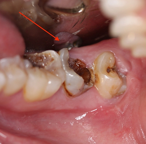 Dành 3 phút trước khi ngủ sẽ không còn hàm răng sâu và ố vàng nữa - 6