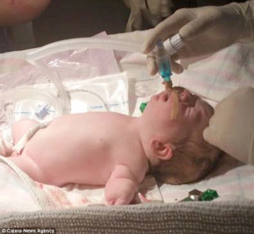 Em bé kỳ lạ 3 lần được báo đã chết trong bụng mẹ vẫn sống sót - 2