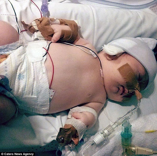 Em bé kỳ lạ 3 lần được báo đã chết trong bụng mẹ vẫn sống sót - 3