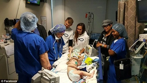 Hai bé trai song sinh liền đầu lần đầu được nhìn thấy nhau sau phẫu thuật - 3