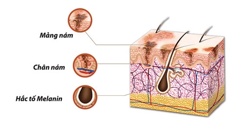 Melanin kẻ thù của làn da - 1