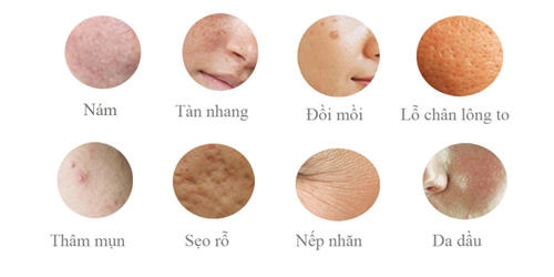 Melanin kẻ thù của làn da - 4