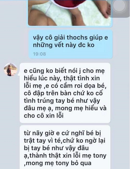 Môt be mâm non gay tay nghi bi cô giáo đanh nha trương noi gi - 4