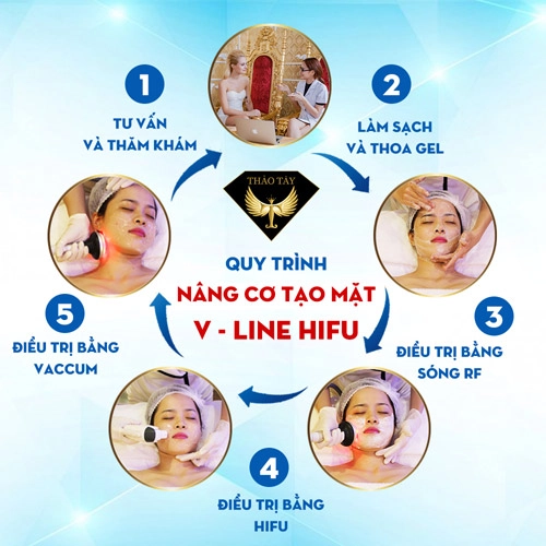 Nâng cơ căng da hifu smas thera an toàn không phẫu thuật - 2