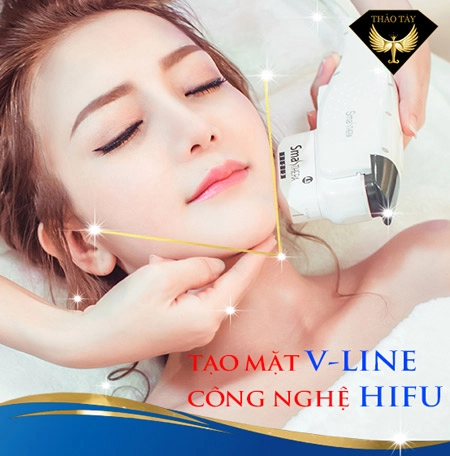 Nâng cơ căng da hifu smas thera an toàn không phẫu thuật - 3