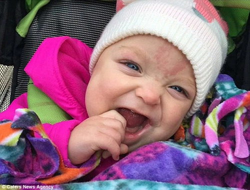 Nụ cười ngọt lịm của bé sơ sinh từng không thể ăn vì lưỡi to cứ cắt lại mọc - 4