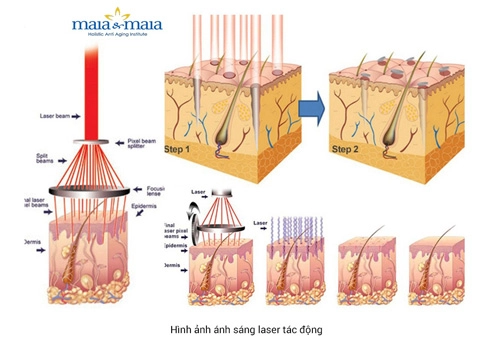 Phương pháp trị rạn làm mưa làm gió 2016 - 2