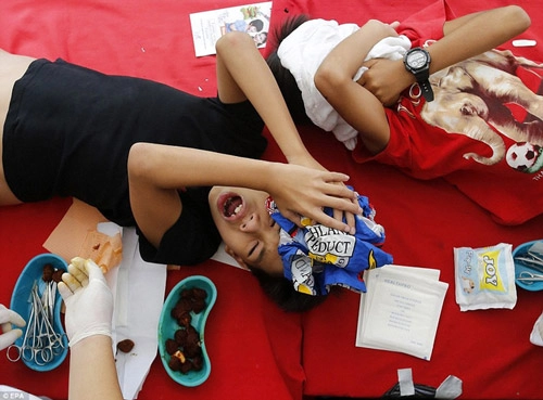 Rùng mình lễ cắt bao quy đầu cho 300 cậu bé tại philippines - 4