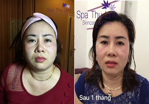 Thu linh spa mở cơ sở mới giúp chị em dễ dàng làm đẹp - 5