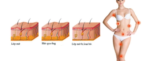  xóa bỏ nỗi lo mỡ thừa của phái đẹp sau tết - 3