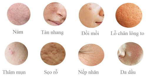 ác mộng nám sẽ còn dai dẳng bởi thói quen này - 3