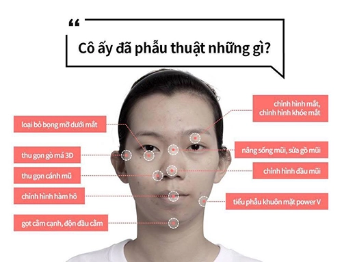 Cô gái 9x hà nội khiến ai cũng ngỡ ngàng vì diện mạo xinh đẹp sau thẩm mỹ - 5