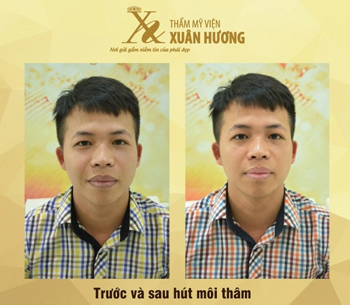 Hậu quả khôn lường từ son môi nhiều chì và hút thuốc lá - 5