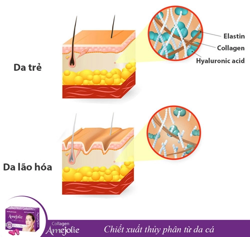 Thiếu hụt collagen đâu là dấu hiệu nhận biết - 1