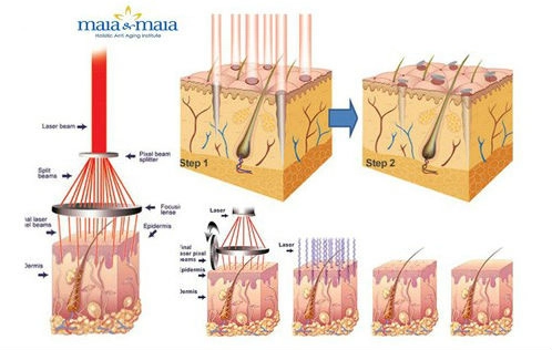 Thoát khỏi ám ảnh rạn da sau sinh với những tuyệt chiêu này - 4