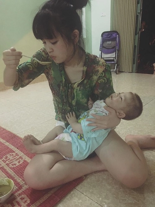 Bé gái lào cai suy dinh dưỡng đã biết chơi đùa sau gần 1 năm được cứu sống - 7