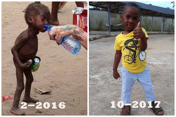 Hình ảnh mới nhất của cậu bé từng bị bỏ đói được giải cứu gây chấn động thế giới - 1