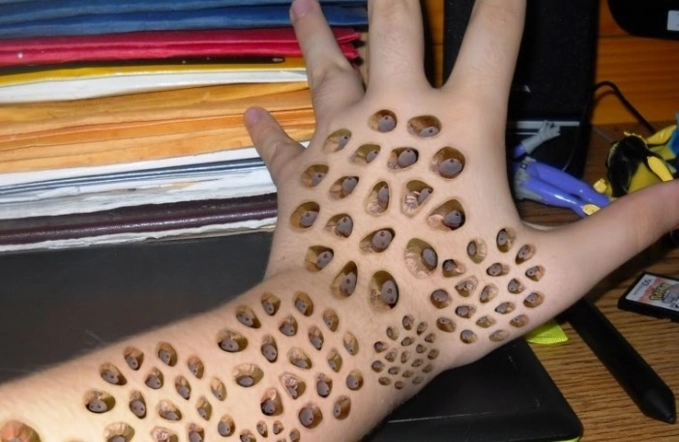 Bạn biết gì về hội chứng sợ lỗ - trypophobia - 5