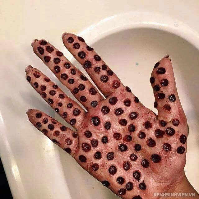 Bạn biết gì về hội chứng sợ lỗ - trypophobia - 8