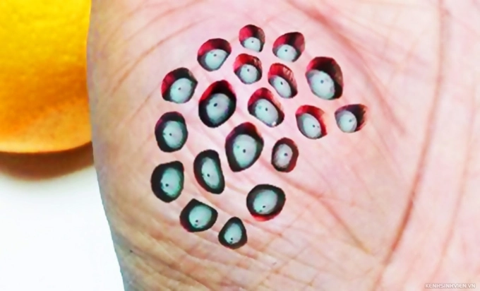 Bạn biết gì về hội chứng sợ lỗ - trypophobia - 11