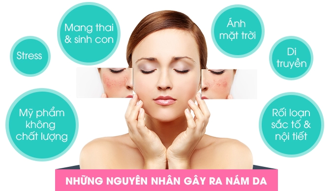 Bị nám da cứ lấy nắm giá đỗ và củ cải làm thế này sau 2 tuần là sạch bách - 1