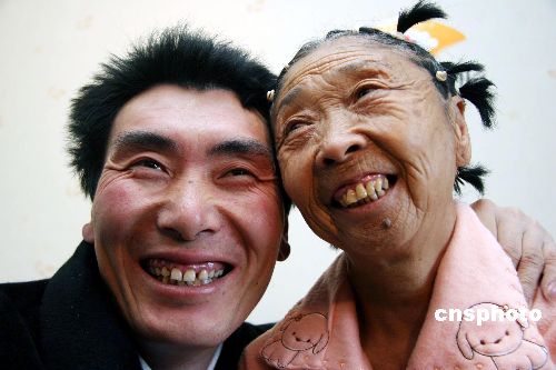 Cụ bà 71 tuổi quyết phẫu thuật thẩm mỹ để đẹp đôi với người tình 32 tuổi - 6