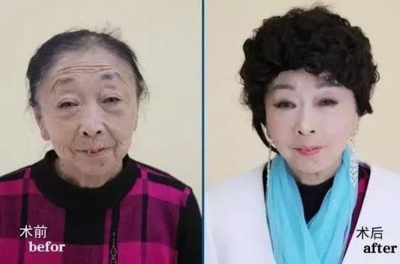 Cụ bà 71 tuổi quyết phẫu thuật thẩm mỹ để đẹp đôi với người tình 32 tuổi - 9