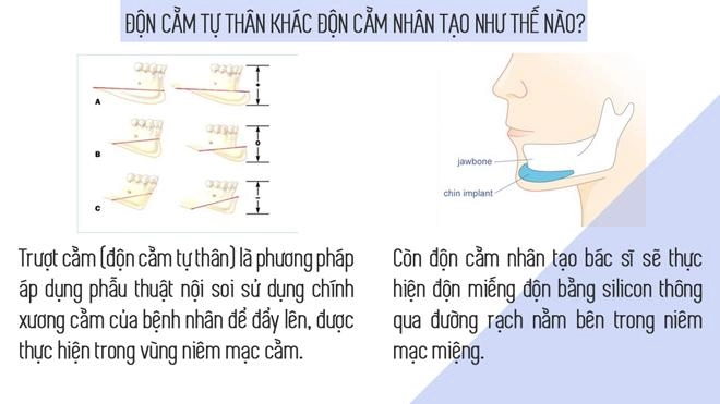 Hết gọt đến độn bằng silicon giờ đây chị em tìm đến phương pháp trượt với chính cằm của mình - 1