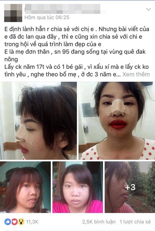 Không thể sống mãi trong diện mạo xấu xí mẹ đơn thân đắk nông quyết tâm đập mặt xây lại - 2