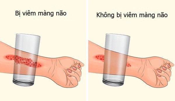 Ngày hè nóng nực thấy trẻ có những biểu hiện này cần gặp bác sĩ ngay kẻo muộn - 4